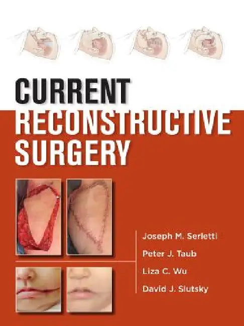 Buy Current Reconstructive Surgery | by Joseph M. Serletti | Peter J. Taub | Liza Wu | McGraw Hill / Medical | by Joseph M. Serletti | Peter J. Taub | Liza Wu | McGraw Hill / Medical | by Joseph M. Serletti | Peter J. Taub | Liza Wu | McGraw Hill / Medical | by Joseph M. Serletti | Peter J. Taub | Liza Wu | McGraw Hill / Medical | by Joseph M. Serletti | Peter J. Taub | Liza Wu | McGraw Hill / Medical | by Joseph M. Serletti | Peter J. Taub | Liza Wu | McGraw Hill / Medical | by Joseph M. Serletti | โ BookShops.in