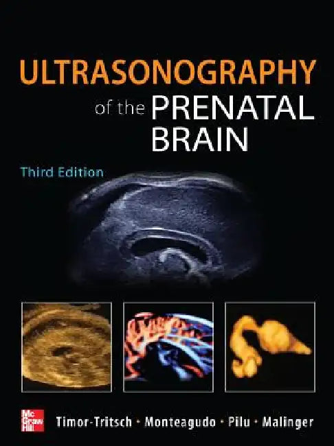 Buy Ultrasonography of the Prenatal Brain (English, Ilan Timor-Tritsch | Ana Monteagudo | Gianluigi Pilu) โ BookShops.in