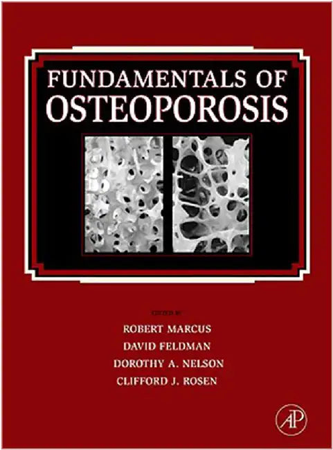 Buy Fundamentals Of Osteoporosis (English, Robert Marcus) — BookShops.in