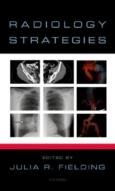 Buy Radiology Strategies | by Julia Fielding | Oxford University Press | by Julia Fielding | Oxford University Press | by Julia Fielding | Oxford University Press | by Julia Fielding | Oxford University Press | by Julia Fielding | Oxford University Press | by Julia Fielding | Oxford University Press | by Julia Fielding | Oxford University Press | by Julia Fielding | Oxford University Press | by Julia Fielding | Oxford University Press | by Julia Fielding | Oxford University Press | by Julia Fielding — BookShops.in