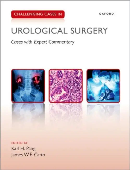 Buy Challenging Cases In Urological Surgery (English, Karl Pang) — BookShops.in