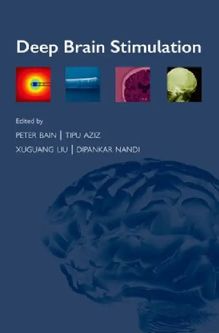 Buy Deep Brain Stimulation (English, Peter Bain | Tipu Aziz | Xuguang Liu) — BookShops.in