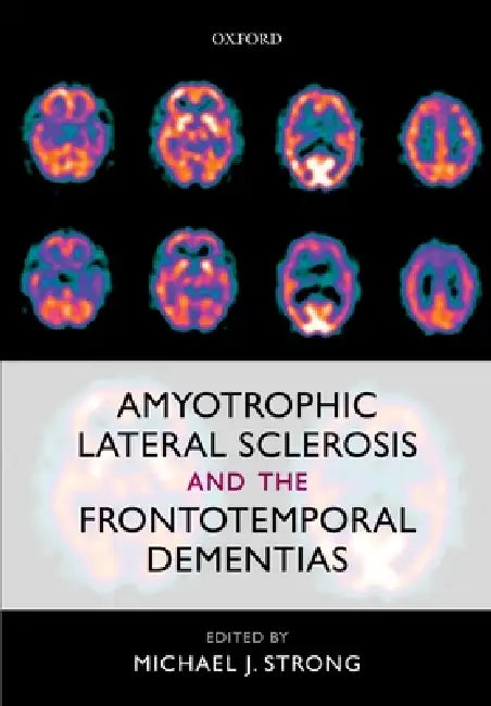 Buy Amyotrophic Lateral Sclerosis and the Frontotemporal Dementias (English, Michael J. Strong) — BookShops.in