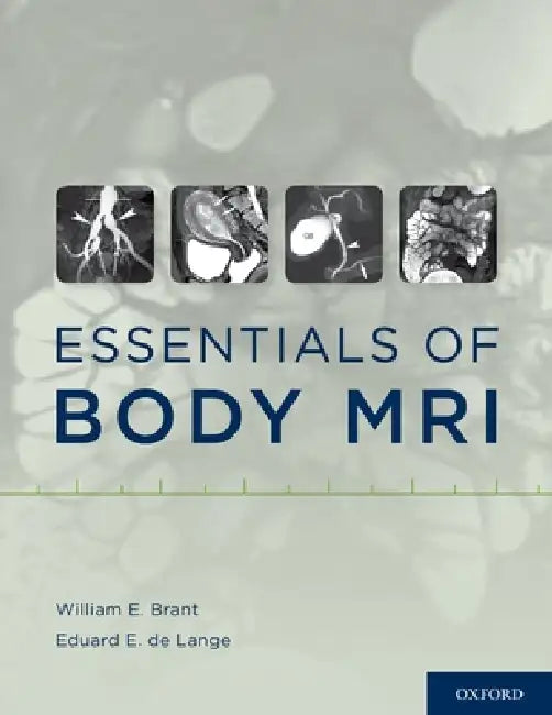 Buy Essentials of Body MRI (English, William E. Brant | Eduard E. de Lange) — BookShops.in