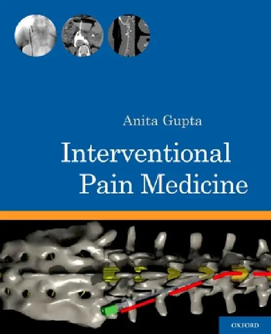 Buy Interventional Pain Medicine | by Anita Gupta | Oxford University Press | by Anita Gupta | Oxford University Press | by Anita Gupta | Oxford University Press | by Anita Gupta | Oxford University Press | by Anita Gupta | Oxford University Press | by Anita Gupta | Oxford University Press | by Anita Gupta | Oxford University Press | by Anita Gupta | Oxford University Press | by Anita Gupta | Oxford University Press | by Anita Gupta | Oxford University Press | by Anita Gupta | Oxford University Pres — BookShops.in