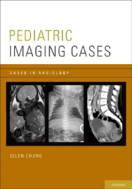 Buy Pediatric Imaging Cases | by Ellen Chung | Oxford Univ PR | by Ellen Chung | Oxford Univ PR | by Ellen Chung | Oxford Univ PR | by Ellen Chung | Oxford Univ PR | by Ellen Chung | Oxford Univ PR | by Ellen Chung | Oxford Univ PR | by Ellen Chung | Oxford Univ PR | by Ellen Chung | Oxford Univ PR | by Ellen Chung | Oxford Univ PR | by Ellen Chung | Oxford Univ PR | by Ellen Chung | Oxford Univ PR | by Ellen Chung | Oxford Univ PR | by Ellen Chung | Oxford Univ PR | by Ellen Chung | Oxford Univ PR — BookShops.in