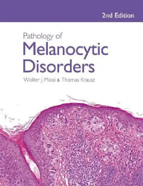 Buy Pathology of Melanocytic Disorders 2ed | by Walter Mooi | Thomas Krausz | CRC Press | by Walter Mooi | Thomas Krausz | CRC Press | by Walter Mooi | Thomas Krausz | CRC Press | by Walter Mooi | Thomas Krausz | CRC Press | by Walter Mooi | Thomas Krausz | CRC Press | by Walter Mooi | Thomas Krausz | CRC Press | by Walter Mooi | Thomas Krausz | CRC Press | by Walter Mooi | Thomas Krausz | CRC Press | by Walter Mooi | Thomas Krausz | CRC Press | by Walter Mooi | Thomas Krausz | CRC Press | by Walter — BookShops.in