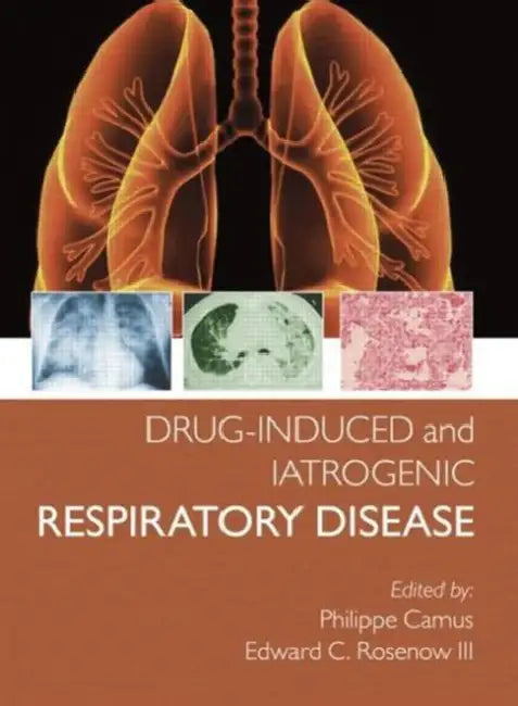 Buy Drug-Induced and Iatrogenic Respiratory Disease (English, Camus Phillipe | Edward Rosenow III) — BookShops.in