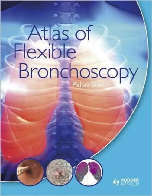 Buy Atlas of Flexible Bronchoscopy (English, Shah Pallav) — BookShops.in