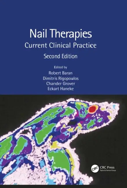 Buy Nail Therapies (English, Baran Robert | Dimitris Rigopoulos | Chander Grover) — BookShops.in