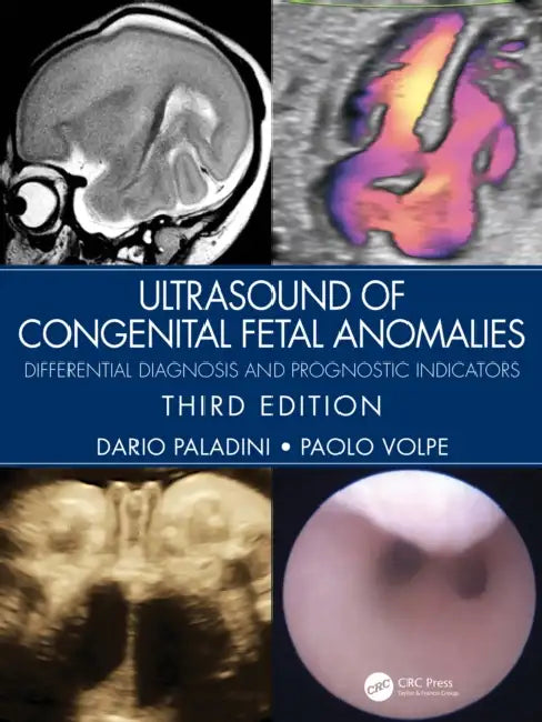 Buy Ultrasound of Congenital Fetal Anomalies (English, Paladini Dario | Paolo Volpe) — BookShops.in