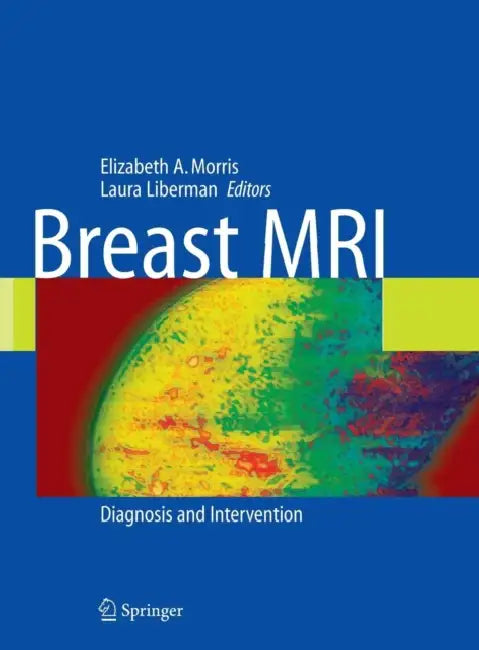 Buy Breast MRI (English, Laura Liberman) — BookShops.in