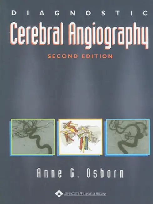 Buy Diagnostic Cerebral Angiography (English, Anne G. Osborn) — BookShops.in