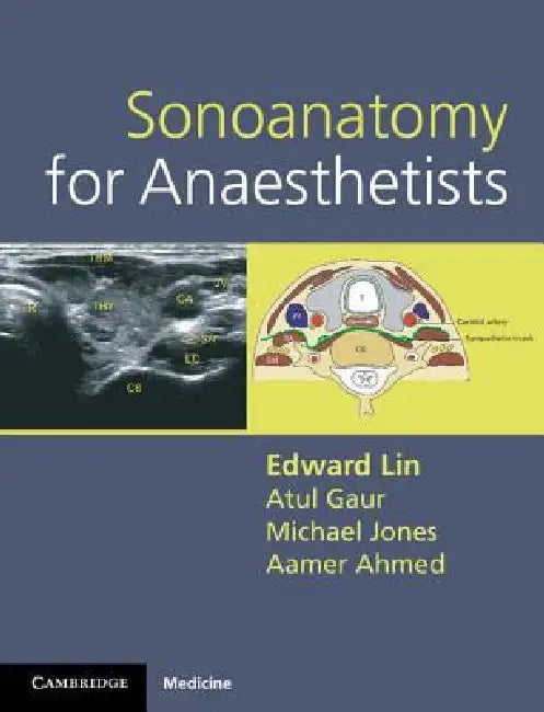 Buy Sonoanatomy for Anaesthetists | by Edward Lin | Atul Gaur | Michael Jones | Cambridge University Press | by Edward Lin | Atul Gaur | Michael Jones | Cambridge University Press | by Edward Lin | Atul Gaur | Michael Jones | Cambridge University Press | by Edward Lin | Atul Gaur | Michael Jones | Cambridge University Press | by Edward Lin | Atul Gaur | Michael Jones | Cambridge University Press | by Edward Lin | Atul Gaur | Michael Jones | Cambridge University Press | by Edward Lin | Atul Gaur | Mi — BookShops.in