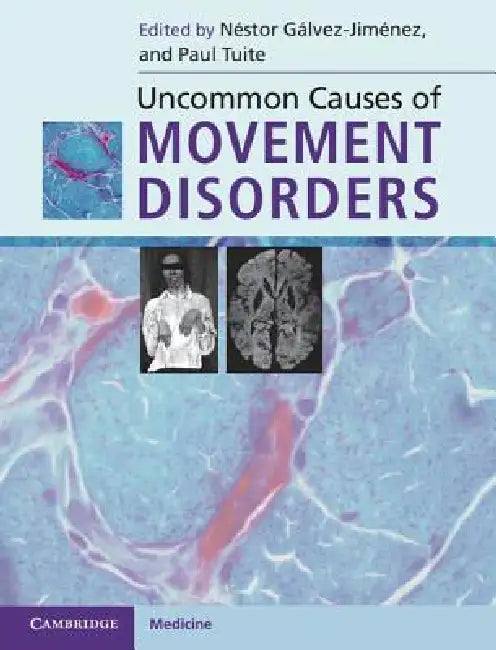 Buy Uncommon Causes of Movement Disorders (English, Néstor Gálvez-Jiménez | Paul Tuite) — BookShops.in