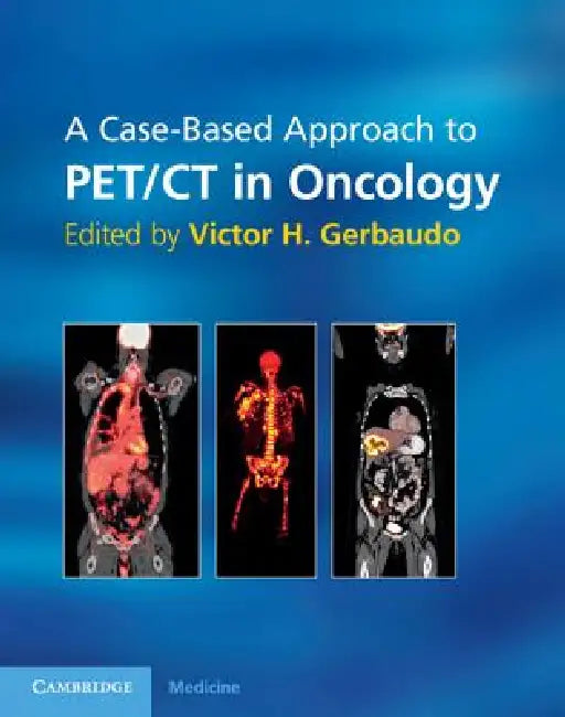 Buy A Case-Based Approach to Pet/CT in Oncology (English, Victor H. Gerbaudo) — BookShops.in