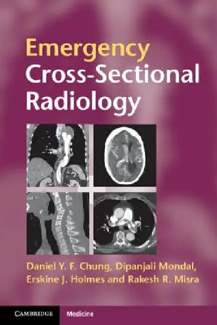 Buy Emergency Cross-Sectional Radiology | by Daniel Y. F. Chung | Dipanjali Mondal | Erskine J. Holmes | Cambridge University Press | by Daniel Y. F. Chung | Dipanjali Mondal | Erskine J. Holmes | Cambridge University Press | by Daniel Y. F. Chung | Dipanjali Mondal | Erskine J. Holmes | Cambridge University Press | by Daniel Y. F. Chung | Dipanjali Mondal | Erskine J. Holmes | Cambridge University Press | by Daniel Y. F. Chung | Dipanjali Mondal | Erskine J. Holmes | Cambridge University Press | by — BookShops.in