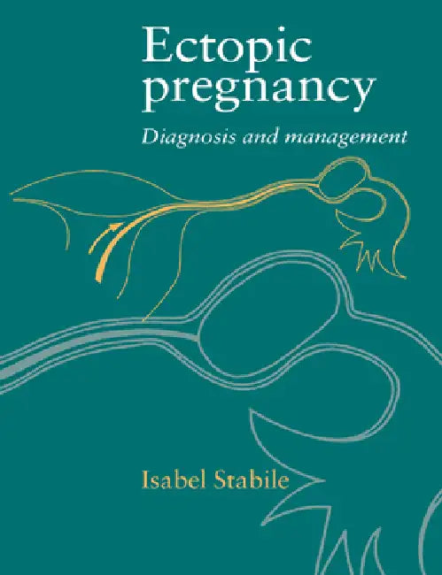 Buy Ectopic Pregnancy (English, Isabel Stabile) — BookShops.in