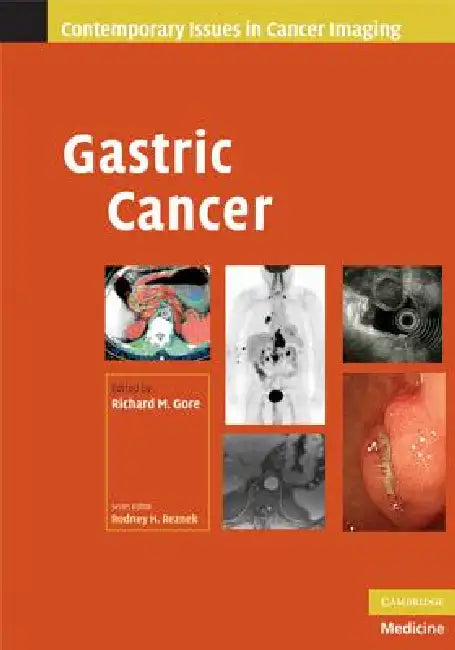 Buy Gastric Cancer (English, Richard M. Gore) — BookShops.in