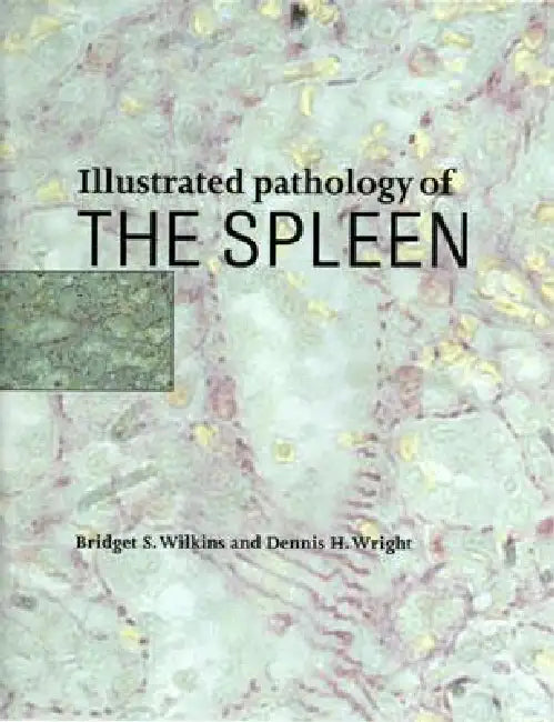 Buy Illustrated Pathology of the Spleen | by Bridget S. Wilkins | Dennis H. Wright | Cambridge University Press | by Bridget S. Wilkins | Dennis H. Wright | Cambridge University Press | by Bridget S. Wilkins | Dennis H. Wright | Cambridge University Press | by Bridget S. Wilkins | Dennis H. Wright | Cambridge University Press | by Bridget S. Wilkins | Dennis H. Wright | Cambridge University Press | by Bridget S. Wilkins | Dennis H. Wright | Cambridge University Press | by Bridget S. Wilkins | Dennis — BookShops.in