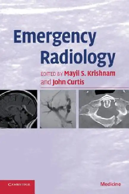Buy Emergency Radiology | by Mayil S. Krishnam | John Curtis | Cambridge University Press | by Mayil S. Krishnam | John Curtis | Cambridge University Press | by Mayil S. Krishnam | John Curtis | Cambridge University Press | by Mayil S. Krishnam | John Curtis | Cambridge University Press | by Mayil S. Krishnam | John Curtis | Cambridge University Press | by Mayil S. Krishnam | John Curtis | Cambridge University Press | by Mayil S. Krishnam | John Curtis | Cambridge University Press | by Mayil S. Kris — BookShops.in