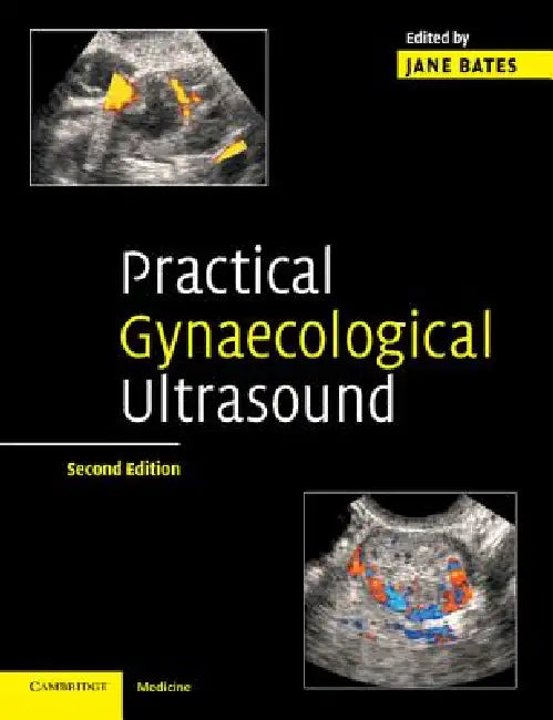 Buy Practical Gynaecological Ultrasound (English, Jane Bates) β BookShops.in