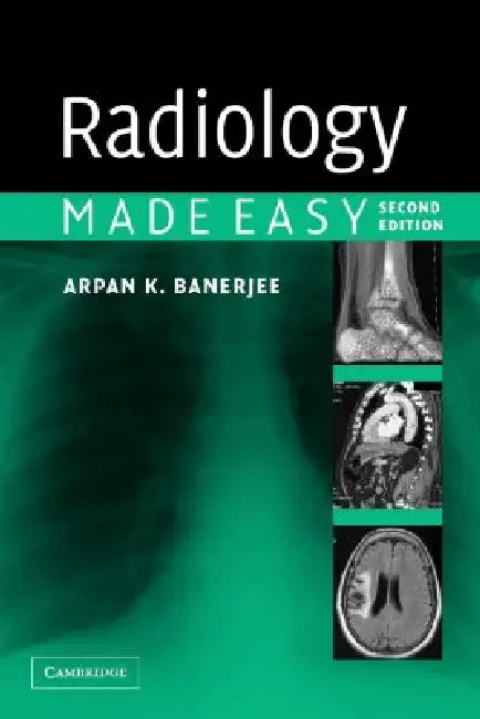 Buy Radiology Made Easy (English, Arpan K. Banerjee) — BookShops.in
