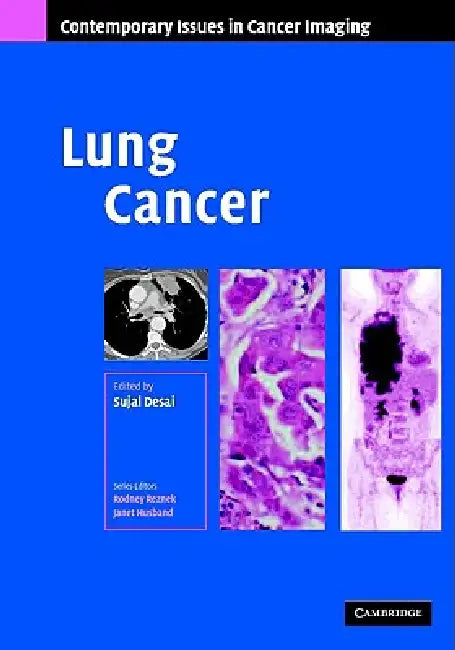 Buy Lung Cancer (English, Sujal R. Desai) — BookShops.in