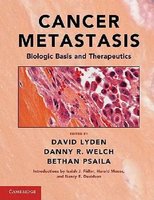 Buy Cancer Metastasis (English, David Lyden | Danny R. Welch | Bethan Psaila) — BookShops.in