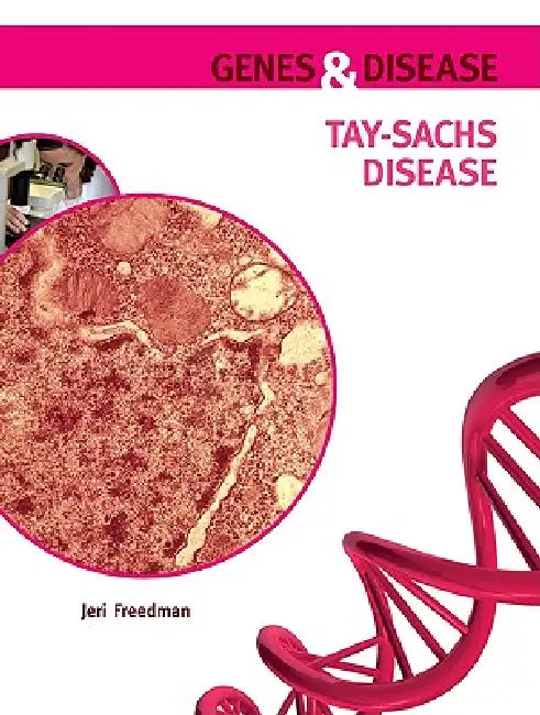 Buy Tay-Sachs Disease (English, Jeri Freedman) — BookShops.in