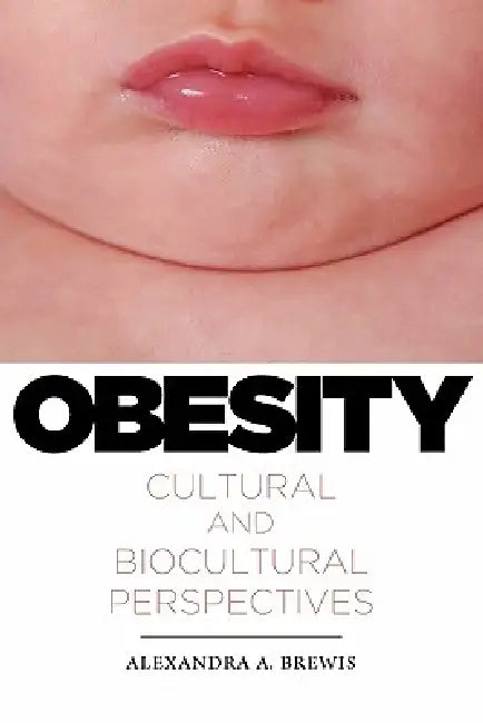 Buy Obesity (English, Alexandra a. Brewis) — BookShops.in