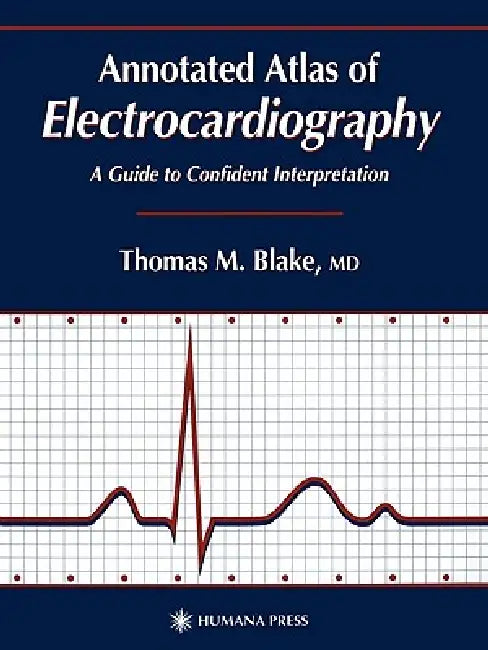 Buy Annotated Atlas of Electrocardiography (English, Thomas M. Blake) β BookShops.in