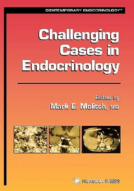 Buy Challenging Cases in Endocrinology (English, Mark E. Molitch) — BookShops.in