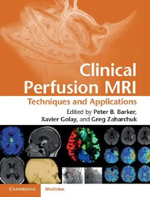 Buy Clinical Perfusion MRI | by Peter B. Barker | Xavier Golay | Gregory Zaharchuk | Cambridge University Press | by Peter B. Barker | Xavier Golay | Gregory Zaharchuk | Cambridge University Press | by Peter B. Barker | Xavier Golay | Gregory Zaharchuk | Cambridge University Press | by Peter B. Barker | Xavier Golay | Gregory Zaharchuk | Cambridge University Press | by Peter B. Barker | Xavier Golay | Gregory Zaharchuk | Cambridge University Press | by Peter B. Barker | Xavier Golay | Gregory Zaharc — BookShops.in