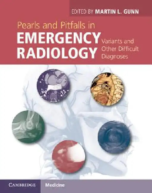 Buy Pearls and Pitfalls in Emergency Radiology | by Martin L. Gunn | Cambridge University Press | by Martin L. Gunn | Cambridge University Press | by Martin L. Gunn | Cambridge University Press | by Martin L. Gunn | Cambridge University Press | by Martin L. Gunn | Cambridge University Press | by Martin L. Gunn | Cambridge University Press | by Martin L. Gunn | Cambridge University Press | by Martin L. Gunn | Cambridge University Press | by Martin L. Gunn | Cambridge University Press | by Martin L. G — BookShops.in