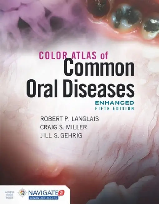 Buy Color Atlas of Common Oral Diseases, Enhanced Edition | by Robert P. Langlais | Craig S. Miller | Jill S. Gehrig | Jones & Bartlett Publishers | by Robert P. Langlais | Craig S. Miller | Jill S. Gehrig | Jones & Bartlett Publishers | by Robert P. Langlais | Craig S. Miller | Jill S. Gehrig | Jones & Bartlett Publishers | by Robert P. Langlais | Craig S. Miller | Jill S. Gehrig | Jones & Bartlett Publishers | by Robert P. Langlais | Craig S. Miller | Jill S. Gehrig | Jones & B — BookShops.in