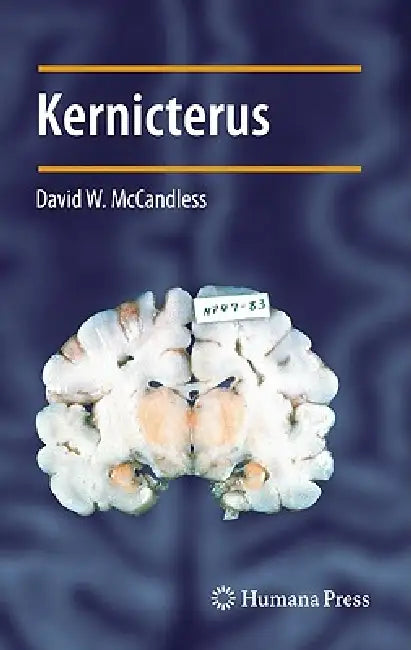 Buy Kernicterus (English, David W. McCandless) — BookShops.in