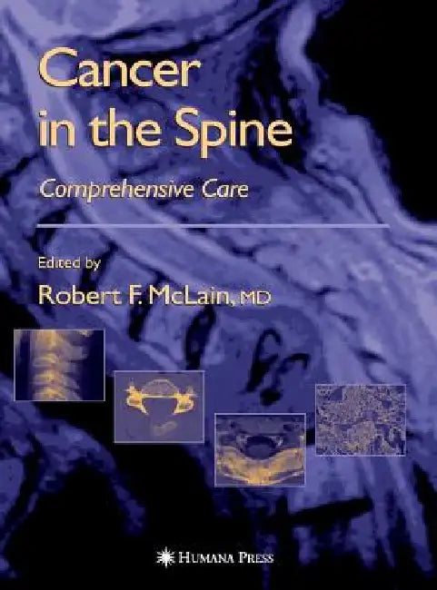 Buy Cancer in the Spine (English, Robert F. McLain | Maurie Markman | Ronald M. Bukowski) — BookShops.in