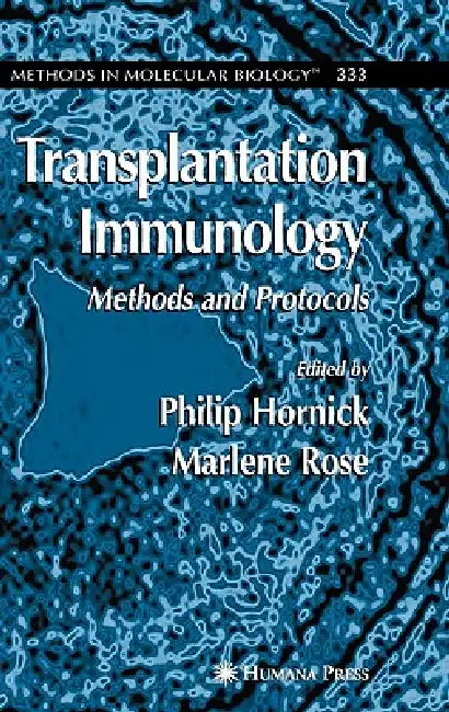 Buy Transplantation Immunology (English, Philip Hornick) — BookShops.in