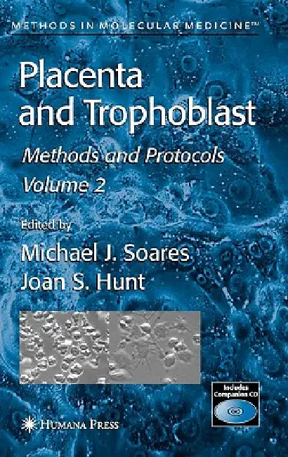 Buy Placenta and Trophoblast (English, Michael J. Soares | Joan S. Hunt) — BookShops.in