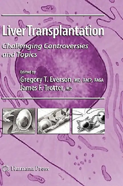 Buy Liver Transplantation (English, Gregory T. Everson | James F. Trotter) — BookShops.in