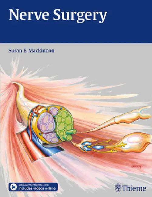 Buy Nerve Surgery (English, Susan E. MacKinnon) — BookShops.in