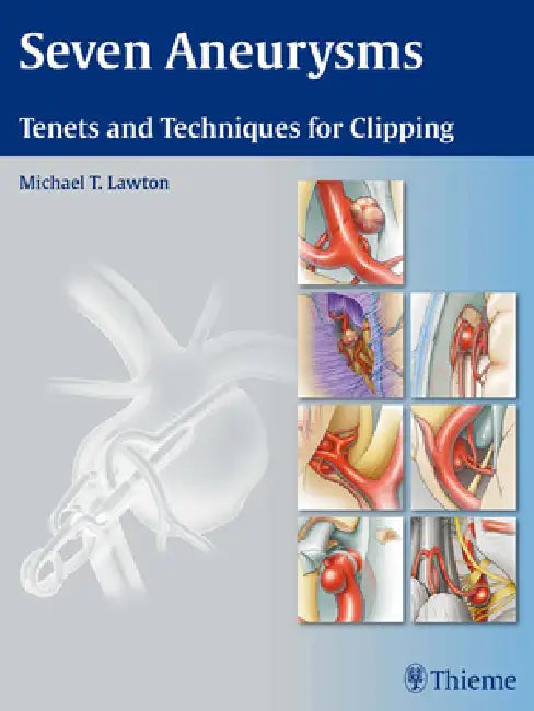 Buy Seven Aneurysms (English, Michael T. Lawton) — BookShops.in