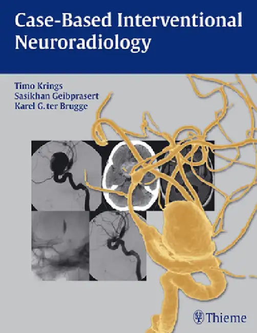 Buy Case-Based Interventional Neuroradiology [With Access Code] | by Timo Krings | Sasikhan Geibprasert | Karel Ter Brugge | Thieme Medical Publishers | by Timo Krings | Sasikhan Geibprasert | Karel Ter Brugge | Thieme Medical Publishers | by Timo Krings | Sasikhan Geibprasert | Karel Ter Brugge | Thieme Medical Publishers | by Timo Krings | Sasikhan Geibprasert | Karel Ter Brugge | Thieme Medical Publishers | by Timo Krings | Sasikhan Geibprasert | Karel Ter Brugge | Thieme Medical Publishers | by  — BookShops.in