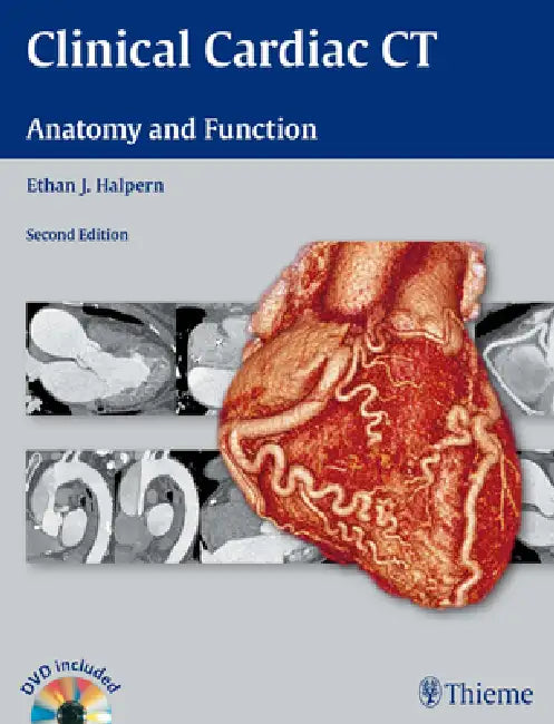 Buy Clinical Cardiac CT (English, Ethan J. Halpern) — BookShops.in