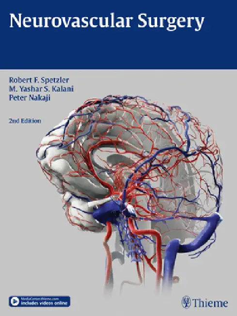 Buy Neurovascular Surgery | by Robert F. Spetzler | M. Yashar Kalani | Peter Nakaji | Thieme Medical Publishers | by Robert F. Spetzler | M. Yashar Kalani | Peter Nakaji | Thieme Medical Publishers | by Robert F. Spetzler | M. Yashar Kalani | Peter Nakaji | Thieme Medical Publishers | by Robert F. Spetzler | M. Yashar Kalani | Peter Nakaji | Thieme Medical Publishers | by Robert F. Spetzler | M. Yashar Kalani | Peter Nakaji | Thieme Medical Publishers | by Robert F. Spetzler | M. Yashar Kalani | Pet — BookShops.in