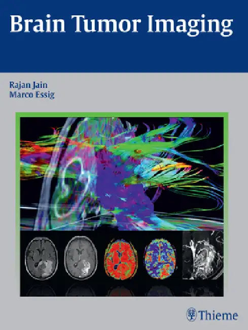 Buy Brain Tumor Imaging (English, Rajan Jain | Marco Essig) — BookShops.in