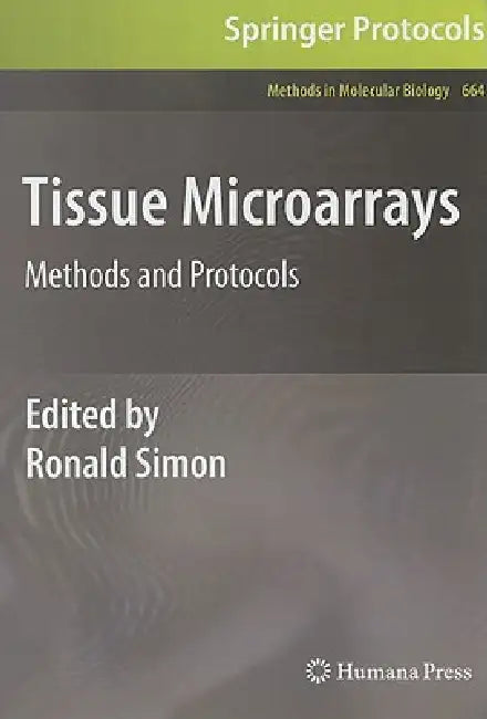 Buy Tissue Microarrays (English, Ronald Simon) — BookShops.in