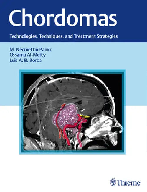 Buy Chordomas (English, M. Necmettin Pamir | Ossama Al-Mefty | Luis Borba) — BookShops.in
