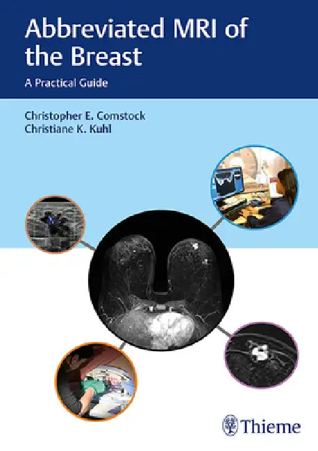 Buy Abbreviated MRI of the Breast (English, Christopher E. Comstock | Christiane Kuhl) — BookShops.in